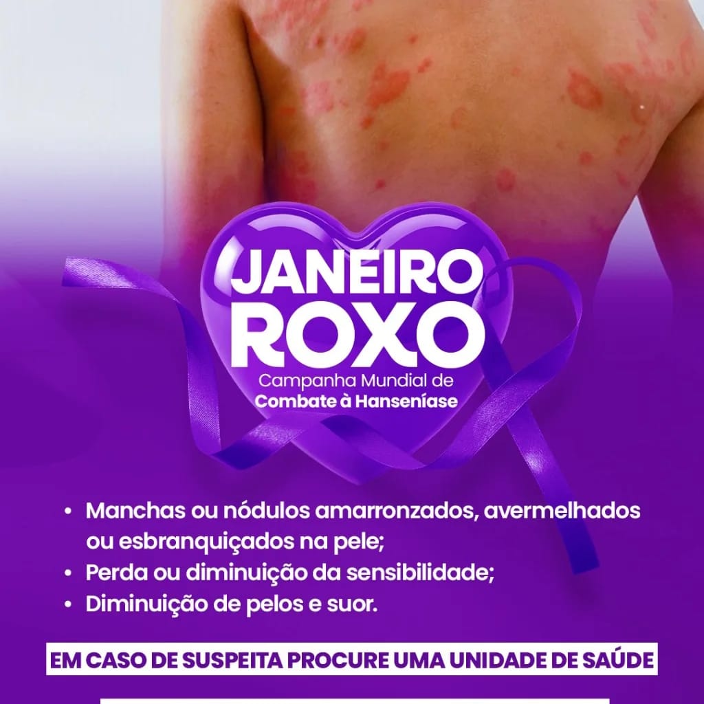 Palestra em Alusão ao JANEIRO ROXO